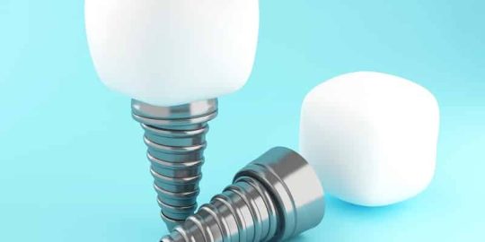 Dental Implants Gives Us A Youthful Smile