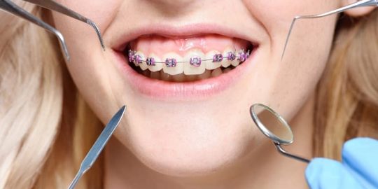 Best Dental Treatments For Improving Your Smile