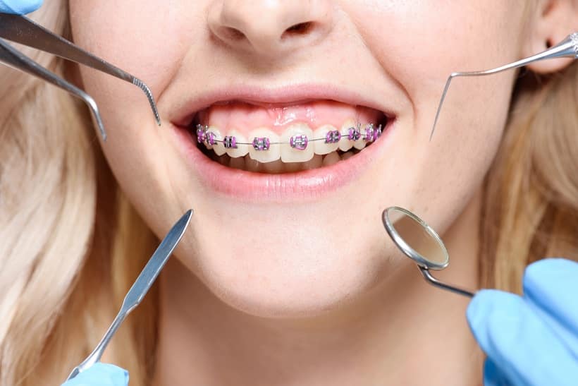 closeup shot of dentist tools in front of smiling