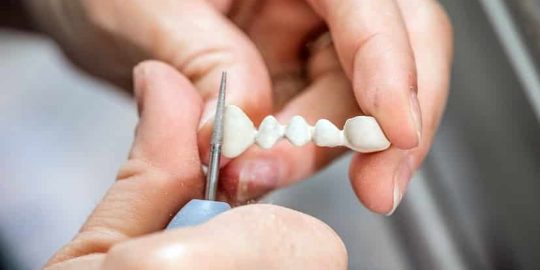 Dental Bridges Will Give A Proper Shape to Your Mouth