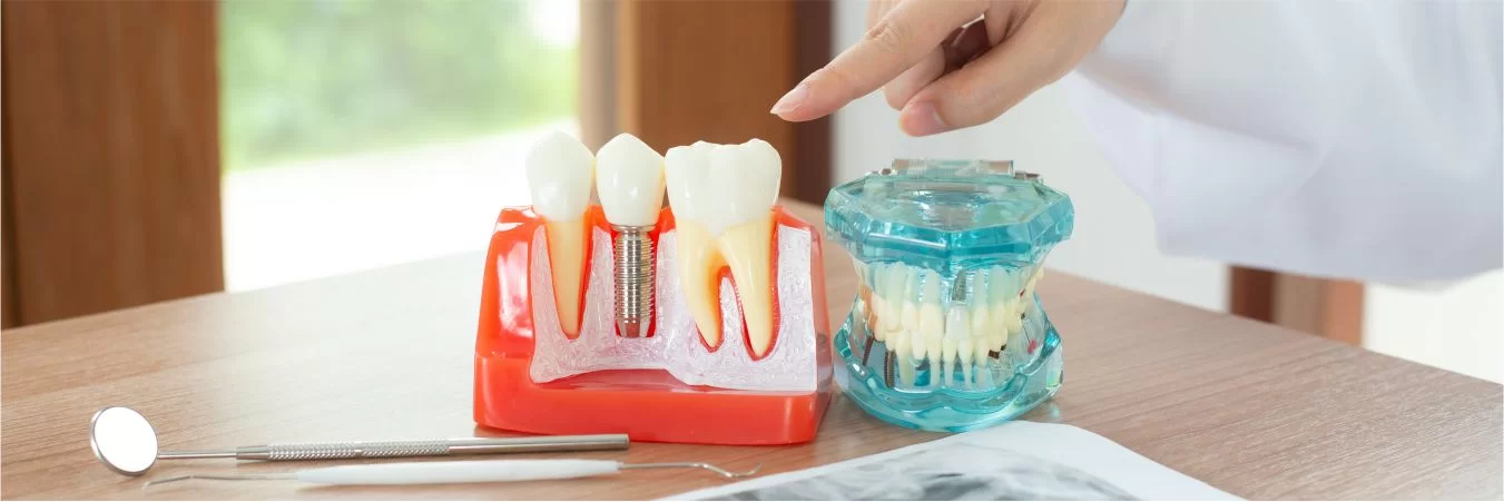 Emergency Dentist In Carrollton