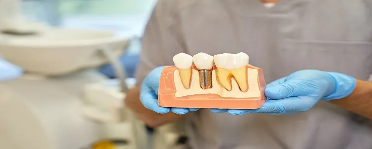 Dental Implants Insurance