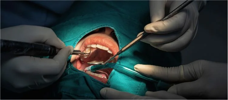 Dental Implants Plano