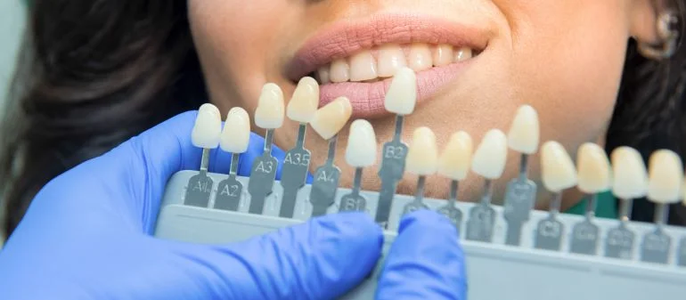 Teeth Whitening Plano