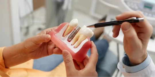 5 Affordable Dental Options for Replacing Missing Teeth