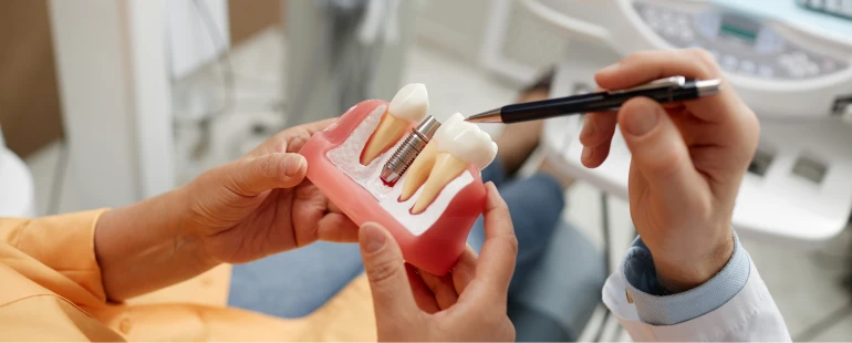 Dental options for missing teeth