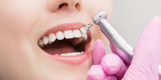 How To Treat Burned Gums From Teeth Whitening?