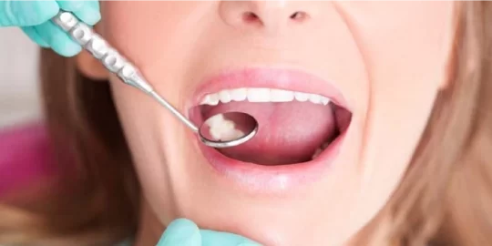 Exploring The Link Between Poor Oral Hygiene and Oral Cancer By Dr.Jang