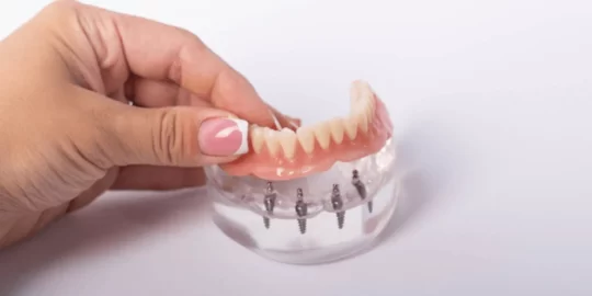 How To Maintain All-On-4 Dental Implants Properly?