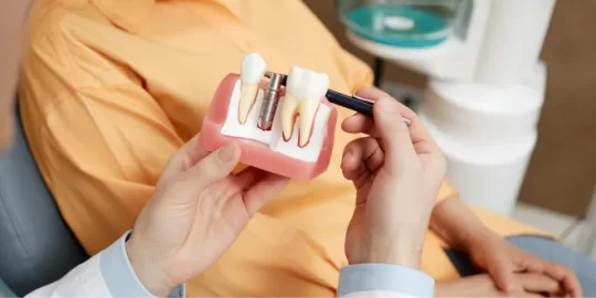 What Is The Recovery Process For All-On-4 Dental Implants?