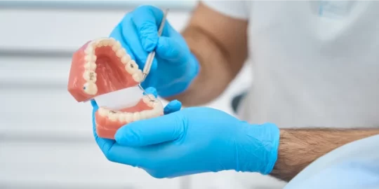The Benefits Of Dental Implants Over Dentures