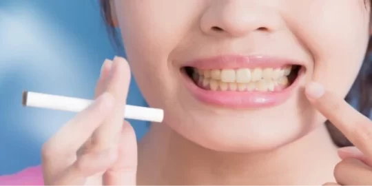 How Does Smoking Affect Dental Implants?