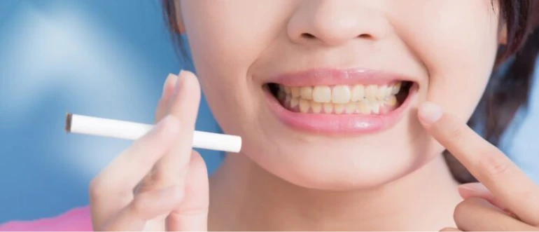Smoking and Dental Implants: Impact and Risks