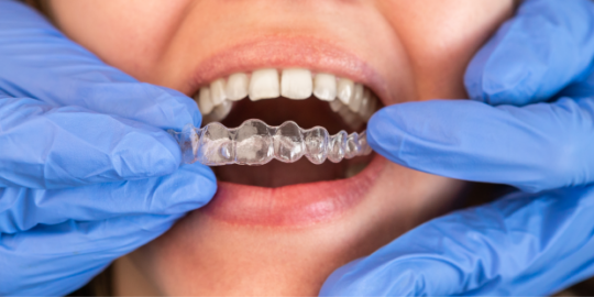 Does Invisalign Hurt?