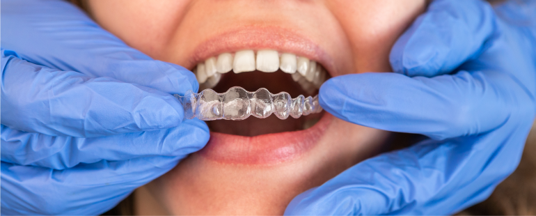 Invisalign dental treatment hurt