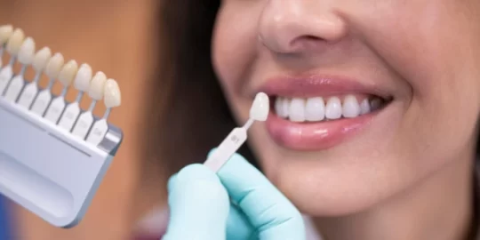 Can You Whiten a Dental Crown?