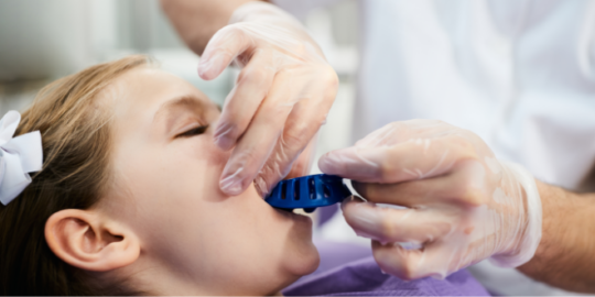 Do’s And Don’ts After Tooth Extraction