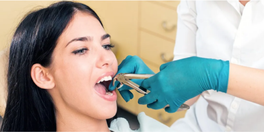 Understanding The Different Types of Dental Extractions