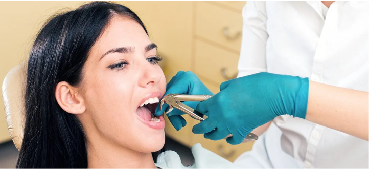 Dental Extraction Guide
