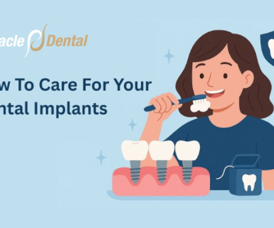 How To Care For Your Dental Implants